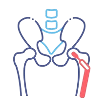 Total_Hip_Replacement removebg preview min